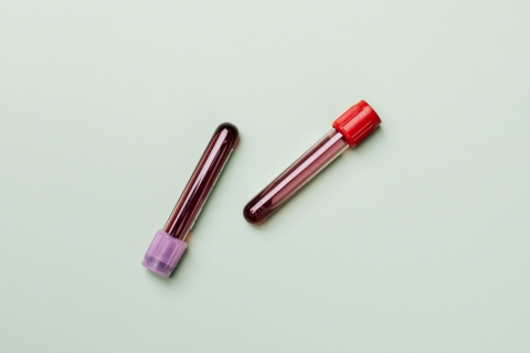 Image of Blood test tubes